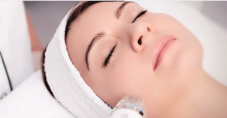 Microneedling Münster