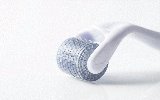 microneedling-oldenburg-hautroller Microneedling Oldenburg Hautroller