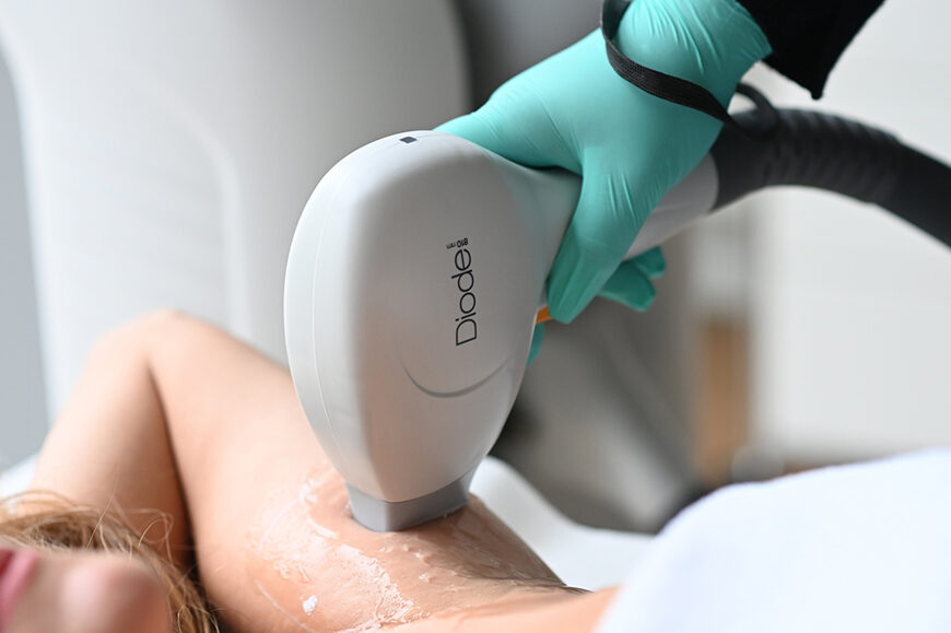 Haarentfernung mit primelase® Diodenlaser-Technologie