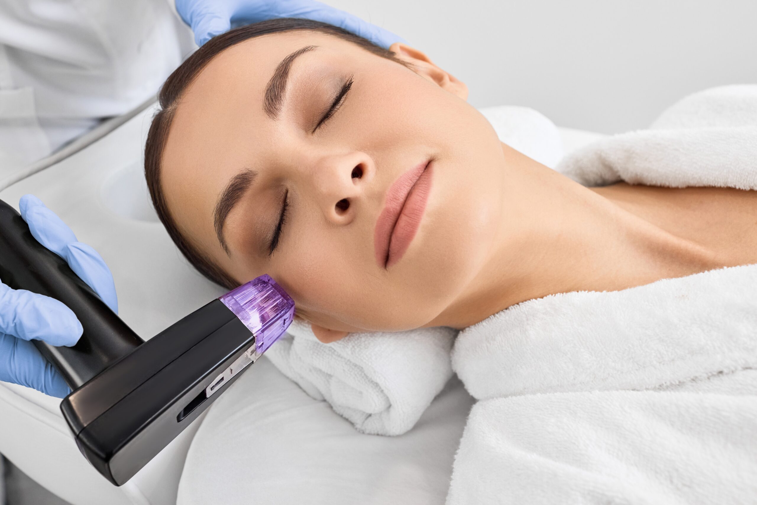 Secret RF Microneedling Kosmetikstudio Bremen